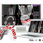 software for guided surgery ImplaStation