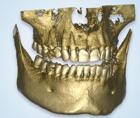 3D X-ray (CBCT) upload